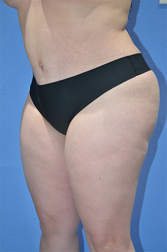 After Image