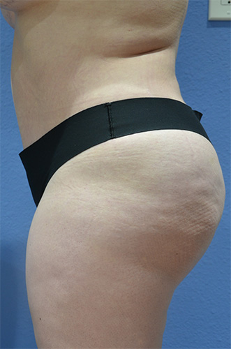 After Image