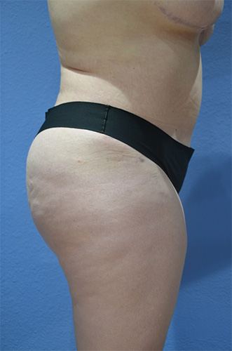 After Image