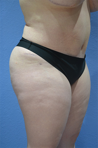 After Image