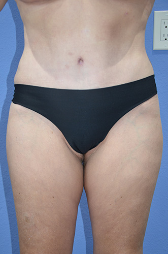 After Image