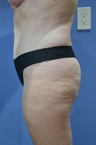 After Image