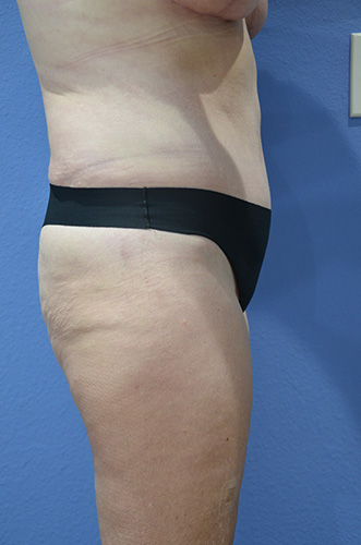 After Image
