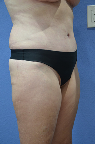 After Image