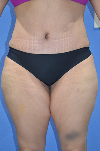 After Image