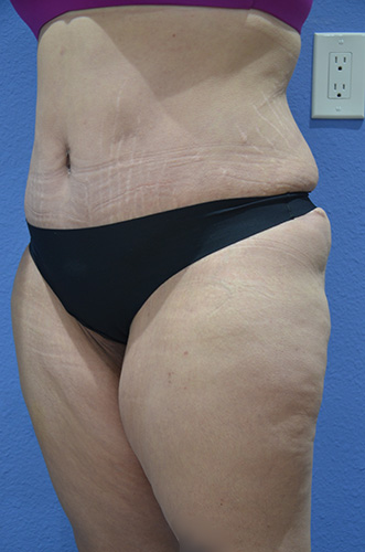 After Image