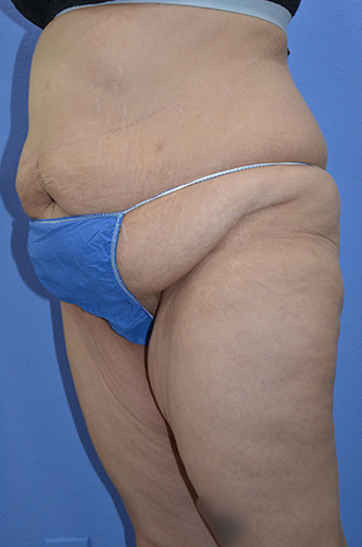 Before Image