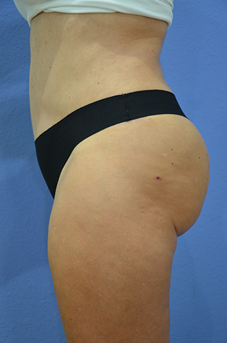 After Image
