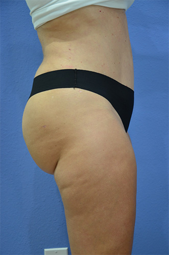 After Image
