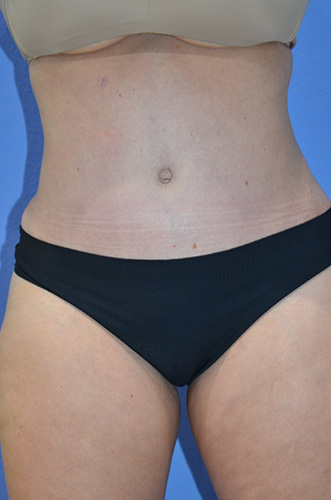 After Image