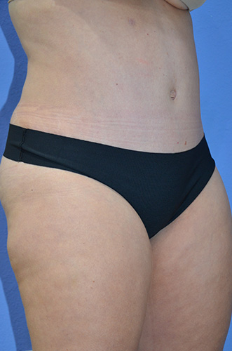 After Image