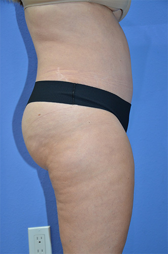 After Image