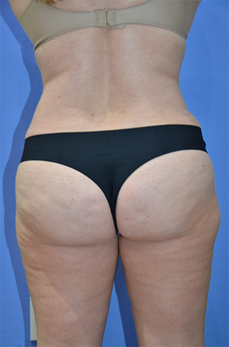 After Image