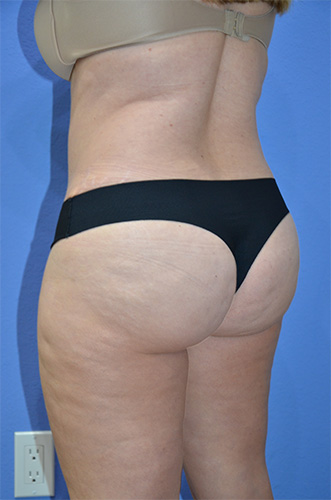 After Image